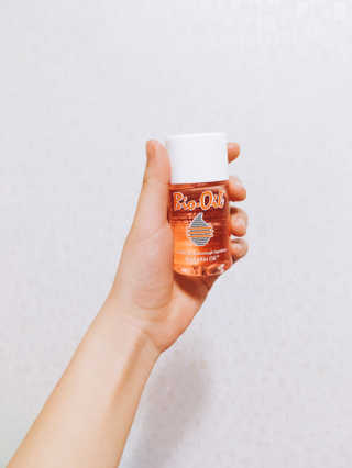 Bio-oil(바이오오일) 바이오오일(Bio-oil) — 4점을 준 리뷰어가 2017년 2월 올린 사용 사진