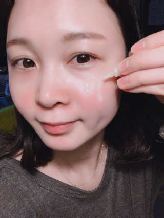 히스토메르 코리아 히스토메르씨-멀티 액션 퓨어 비타민 — 5점을 준 리뷰어가 2019년 1월 올린 사용 사진