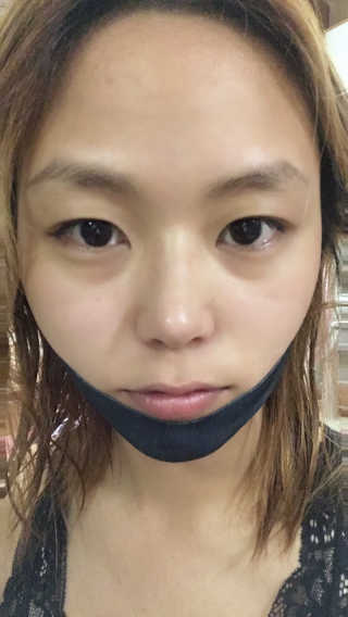 어웨이크어슬립 어슬립 페이스 리프트업 밴드 — 5점을 준 리뷰어가 2018년 6월 올린 사용 사진