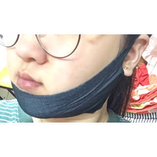 어웨이크어슬립 어슬립 페이스 리프트업 밴드 — 3.83점을 준 리뷰어가 2018년 5월 올린 사용 사진