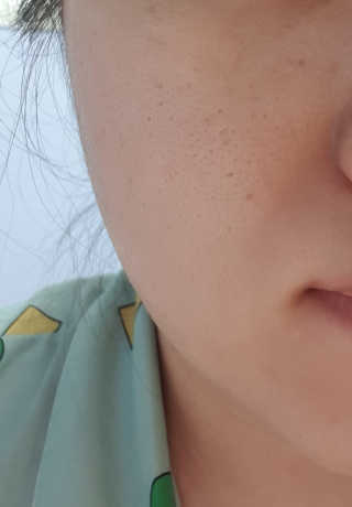지고트 비타솔루션12 퍼밍 앰플 크림 100ml — 5점을 준 리뷰어가 2019년 8월 올린 사용 사진