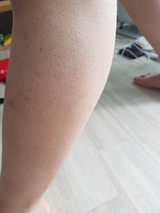빨간머리앤님이 올린 리뷰 사진 4