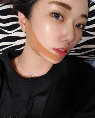 아이디플라코스메틱 아이디 페이스핏 마이너스 밴드 — 5점을 준 리뷰어가 2020년 1월 올린 사용 사진