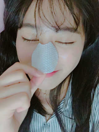 나이팅게일-토닝 필링패드 허니 — 5점을 준 리뷰어가 2017년 5월 올린 사용 사진