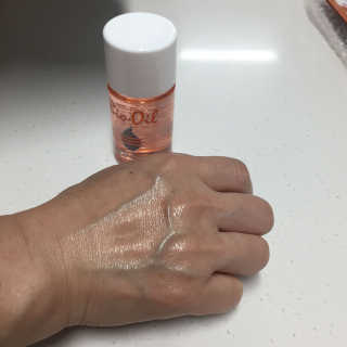 Bio-oil(바이오오일) 바이오오일 — 4점을 준 리뷰어가 2016년 10월 올린 사용 사진