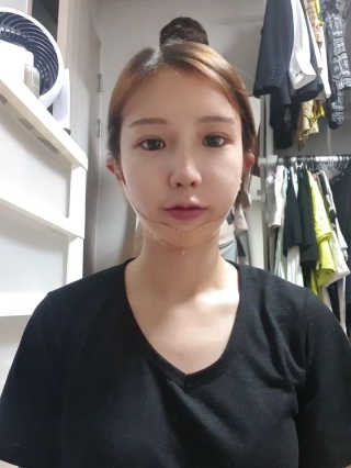 아이디플라코스메틱 아이디 페이스핏 마이너스 밴드 — 5점을 준 리뷰어가 2019년 9월 올린 사용 사진
