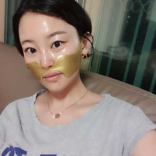[스케덤] 상악밴드 — 5점을 준 리뷰어가 2019년 7월 올린 사용 사진