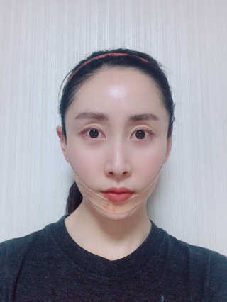 아이디플라코스메틱 아이디 페이스핏 마이너스 밴드 — 4.5점을 준 리뷰어가 2019년 10월 올린 사용 사진