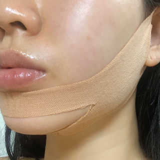 아이디플라코스메틱 아이디 페이스핏 마이너스 밴드 — 4.5점을 준 리뷰어가 2019년 9월 올린 사용 사진