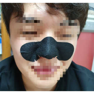 미팩토리 3단 돼지코팩 1box + 3단 흑돼지코팩 1box — 5점을 준 리뷰어가 2019년 8월 올린 사용 사진