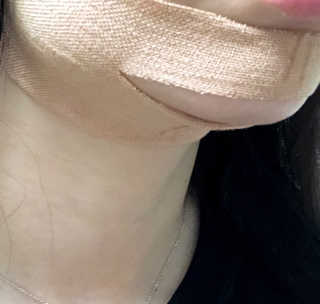 아이디플라코스메틱 아이디 페이스핏 마이너스 밴드 — 5점을 준 리뷰어가 2019년 9월 올린 사용 사진