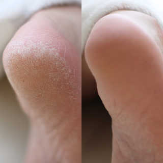치즈님이 올린 리뷰 사진 2