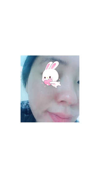 셀레뷰 슈퍼 모이스처 수딩젤 — 4.5점을 준 리뷰어가 2018년 3월 올린 사용 사진