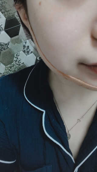 아이디플라코스메틱 아이디 페이스핏 마이너스 밴드 — 3점을 준 리뷰어가 2019년 11월 올린 사용 사진