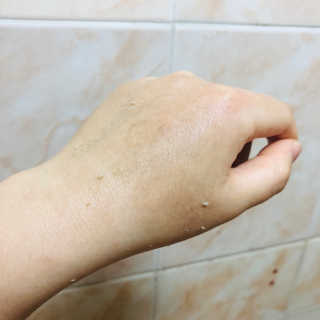 타임인네이처 [더메디닥터] 카렌듈라 엔자임 필링젤 — 5점을 준 리뷰어가 2019년 3월 올린 사용 사진