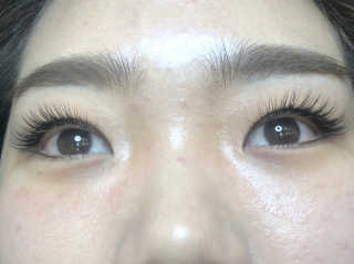 Viewty Skin and Lash [ViewtySkin＆Lash] 종아리 림프순환 부종관리 — 3점을 준 리뷰어가 2019년 2월 올린 사용 사진
