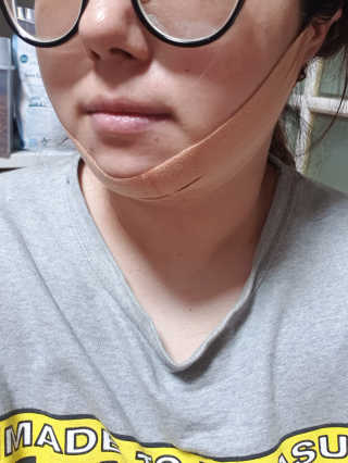 아이디플라코스메틱 아이디 페이스핏 마이너스 밴드 — 4점을 준 리뷰어가 2019년 9월 올린 사용 사진