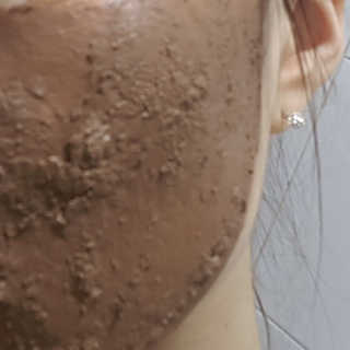 글랜무어 포어 포졸라닉 타이트닝 팩 — 4.17점을 준 리뷰어가 2018년 5월 올린 사용 사진
