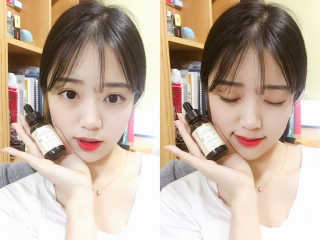 스킨큐어 산다화 비타민씨 화이트닝 에센스 — 4점을 준 리뷰어가 2017년 3월 올린 사용 사진