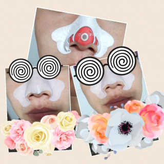 나이팅게일 TAKO PACK NOSE [문어코팩] — 5점을 준 리뷰어가 2017년 3월 올린 사용 사진