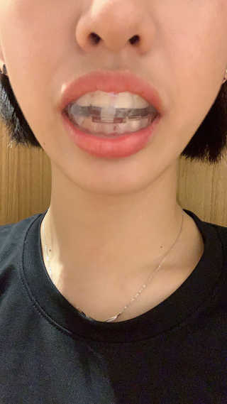 이지닝님이 올린 리뷰 사진 3