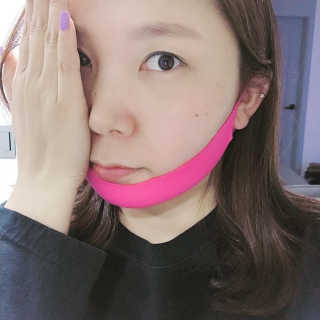 스케덤 펩타이드 리프팅밴드 — 1점을 준 리뷰어가 2019년 4월 올린 사용 사진