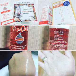 Bio-oil(바이오오일) 바이오오일 — 4.5점을 준 리뷰어가 2016년 10월 올린 사용 사진