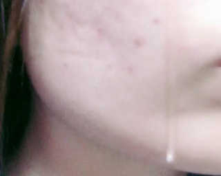 리얼베리어 액티브 브이 퍼스트 오일 — 4점을 준 리뷰어가 2019년 1월 올린 사용 사진