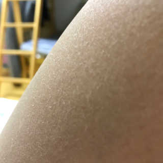 Bio-oil(바이오오일) 바이오오일(Bio-oil) — 5점을 준 리뷰어가 2016년 12월 올린 사용 사진
