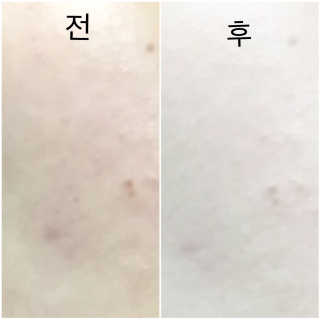 HannahChung님이 올린 리뷰 사진 2