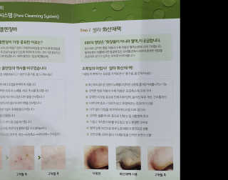 플러스셀라 시카골드 클렌징바 화산재팩 세트 — 4점을 준 리뷰어가 2020년 3월 올린 사용 사진