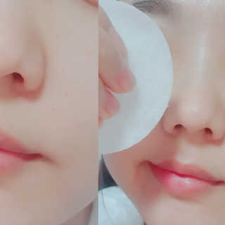 나이팅게일 토닝 필링패드(티트리) — 5점을 준 리뷰어가 2018년 2월 올린 사용 사진