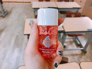 Bio-oil(바이오오일) 바이오오일(Bio-oil) — 4점을 준 리뷰어가 2017년 1월 올린 사용 사진