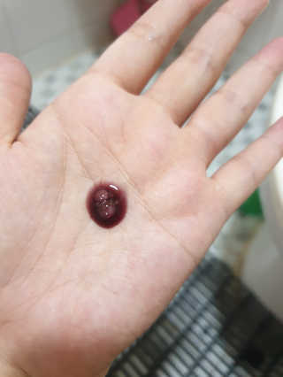 쏘내추럴 레드 필 팅글 세럼 오리지널 — 5점을 준 리뷰어가 2019년 8월 올린 사용 사진