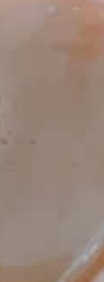 다슈코리아 다슈 데일리 단백질 한방 두피 골드 샴푸 500ml — 5점을 준 리뷰어가 2020년 3월 올린 사용 사진