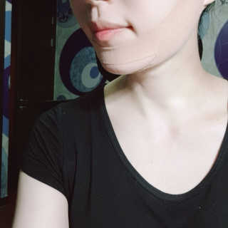 아이디플라코스메틱 아이디 페이스핏 마이너스 밴드 — 4점을 준 리뷰어가 2019년 9월 올린 사용 사진