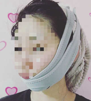 메디미 브이미 업 2스텝 브이라인벨트 — 5점을 준 리뷰어가 2017년 9월 올린 사용 사진