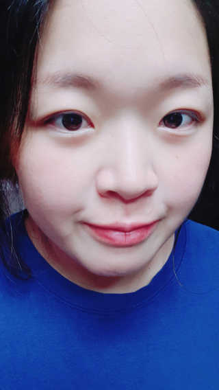 페어아크네 크리미폼 페어아크네 크리미 폼 — 2점을 준 리뷰어가 2019년 9월 올린 사용 사진