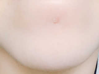 라포랩 laforlab 라포랩 센텔라스카 연고(바질) — 5점을 준 리뷰어가 2017년 12월 올린 사용 사진