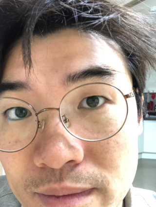 [더마퀸]쿨링스틱 페이스앤아이 — 4점을 준 리뷰어가 2019년 5월 올린 사용 사진