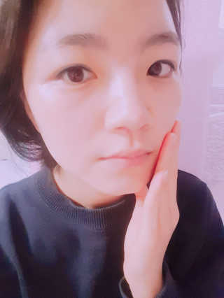 더연 리파이닝 칼라민크림 — 5점을 준 리뷰어가 2017년 11월 올린 사용 사진