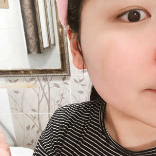 보타니티 [홍]조[진]정[결]케어 플라본 세럼 — 5점을 준 리뷰어가 2018년 5월 올린 사용 사진