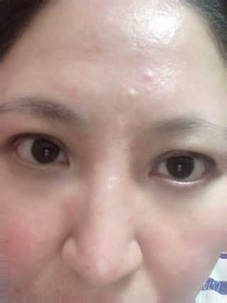 스킨그래머 슈퍼 굿 리페어 에센스 — 5점을 준 리뷰어가 2019년 6월 올린 사용 사진