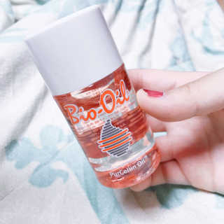 Bio-oil(바이오오일) 바이오오일(Bio-oil) — 5점을 준 리뷰어가 2016년 12월 올린 사용 사진