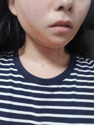 아이디플라코스메틱 아이디 페이스핏 마이너스 밴드 — 4점을 준 리뷰어가 2020년 4월 올린 사용 사진