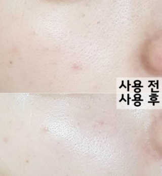 메리에코 단풍 모이스처 에센스 — 4점을 준 리뷰어가 2018년 11월 올린 사용 사진