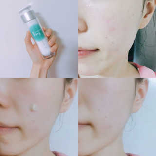 은치치님이 올린 리뷰 사진 1