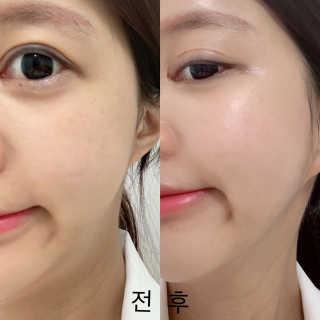 메디타임 멜라반 더마 토닝 씬젤 — 5점을 준 리뷰어가 2019년 5월 올린 사용 사진