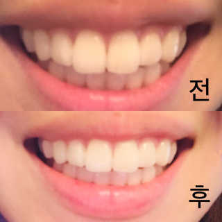the naked object 디블랙팩치약 디블랙칫솔 세트 — 5점을 준 리뷰어가 2018년 12월 올린 사용 사진