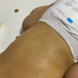 뷰티여우_아토클리닉 [아토클리닉] 아기들이 쓰는 보습, 진정 수딩젤 2개 — 5점을 준 리뷰어가 2019년 5월 올린 사용 사진